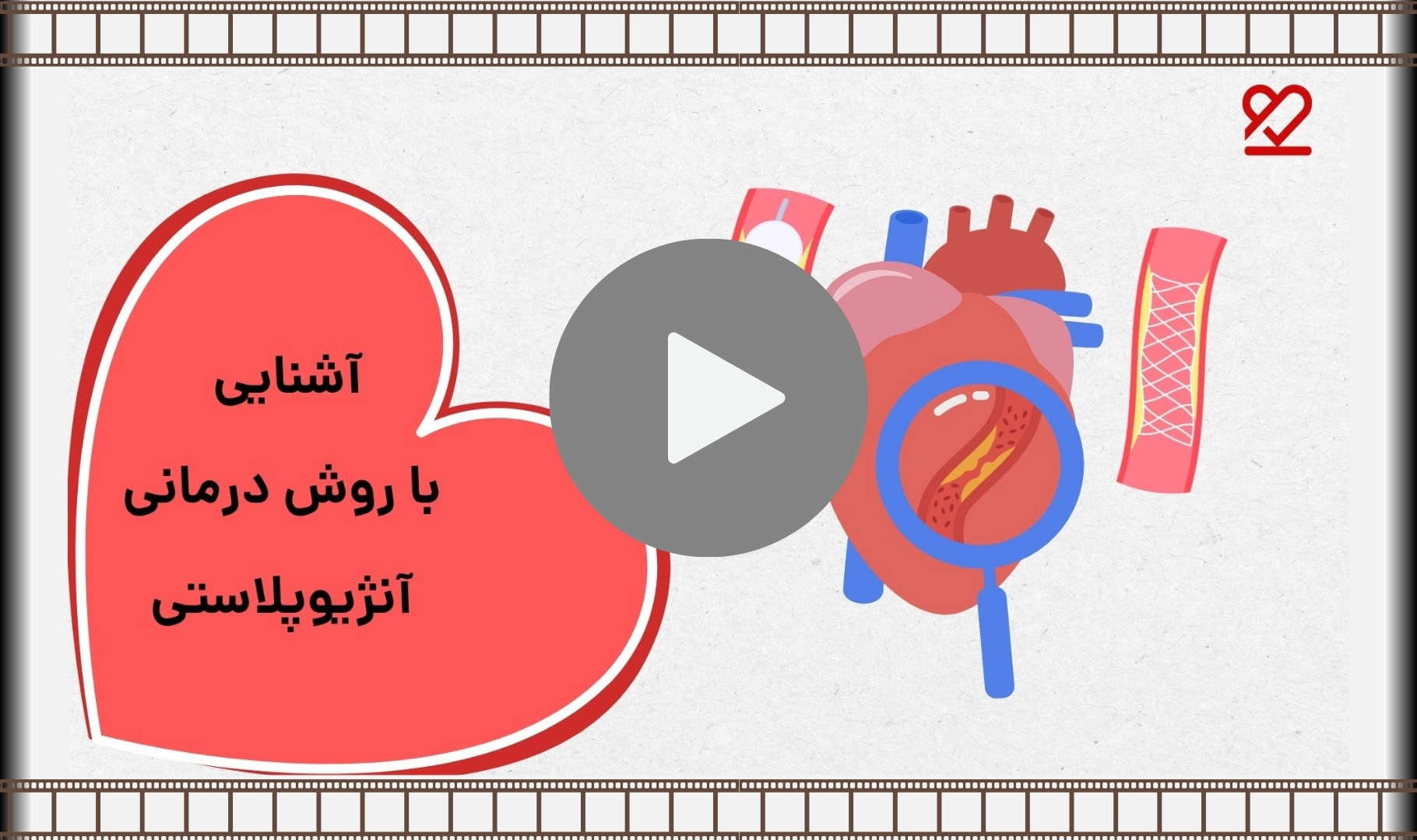 آنژیوگرافی و آنژیوپلاستی