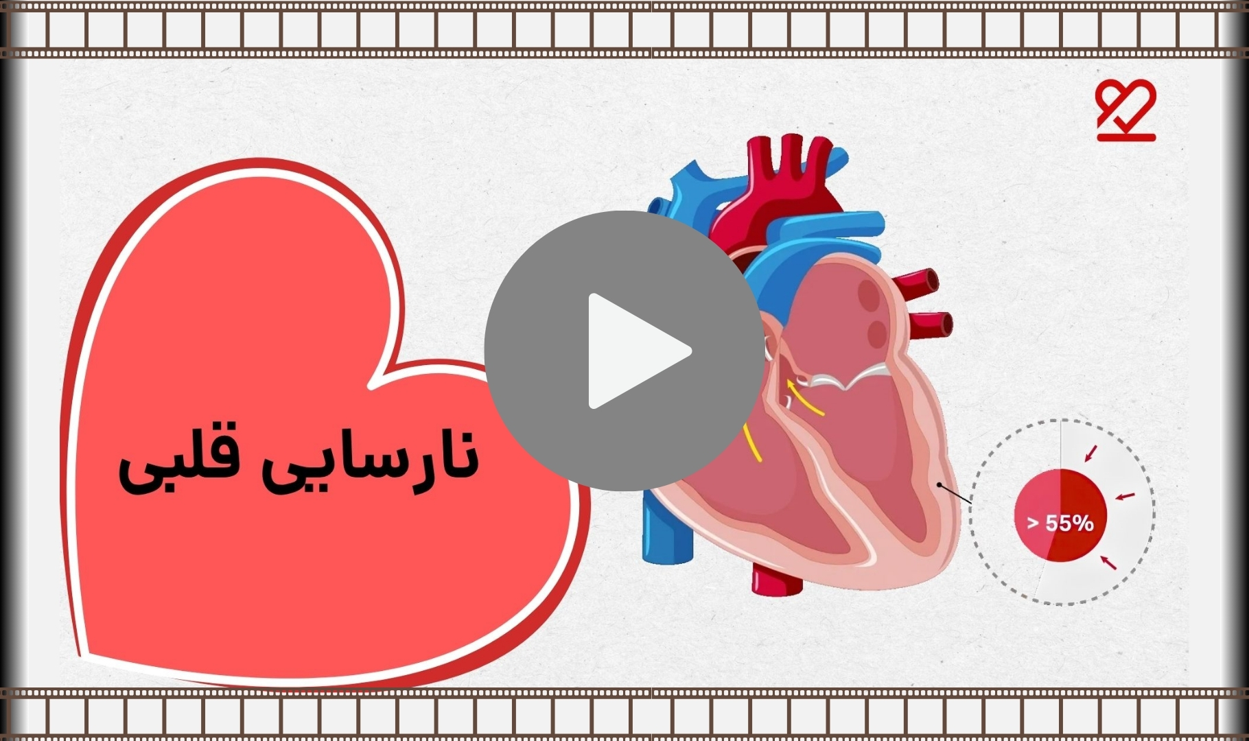 نارسایی قلبی